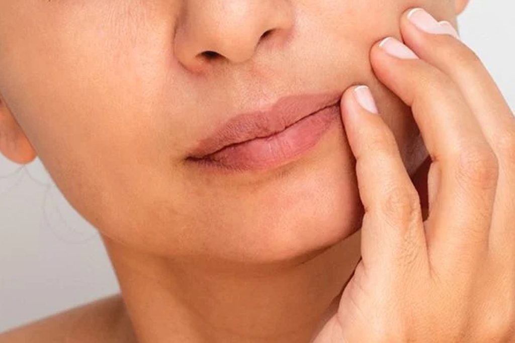 تصویر پوست خشک با ظاهر مات